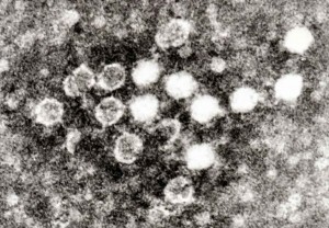 Opname met elektronenmicroscopie van het Parvovirus B19 in bloed. Elk virusdeeltje is ongeveer 25 tot 30 nanometer in diameter.