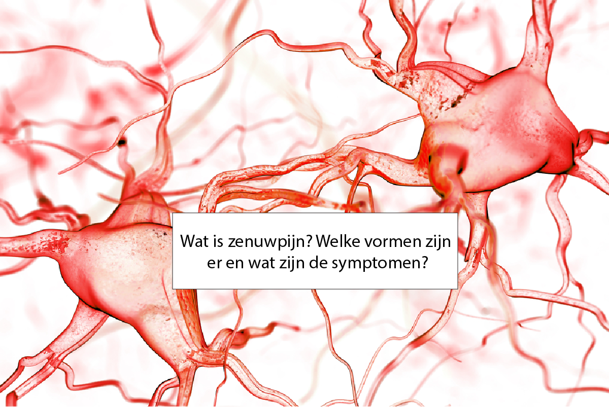 Wat Is Zenuwpijn Welke Vormen Zijn Er En Wat Zijn De Symptomen 