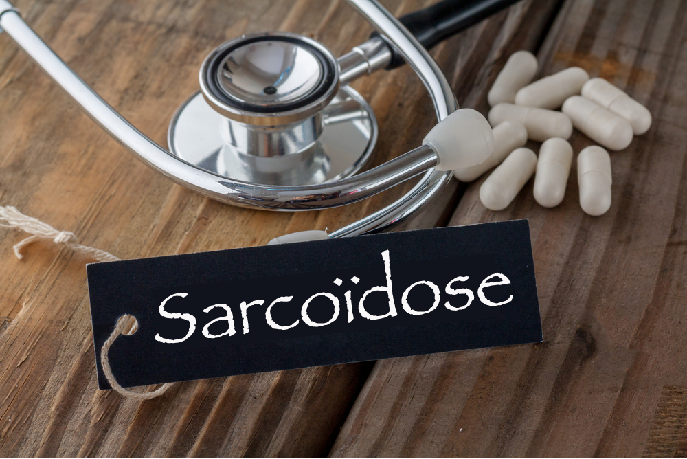 Afbeeldingsresultaat voor sarcoidose