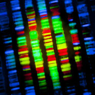 52 nieuwe genen ontdekt die artrose kunnen veroorzaken