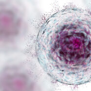 Stamcellen verbeteren kwaliteit van leven bij artrose met 290%