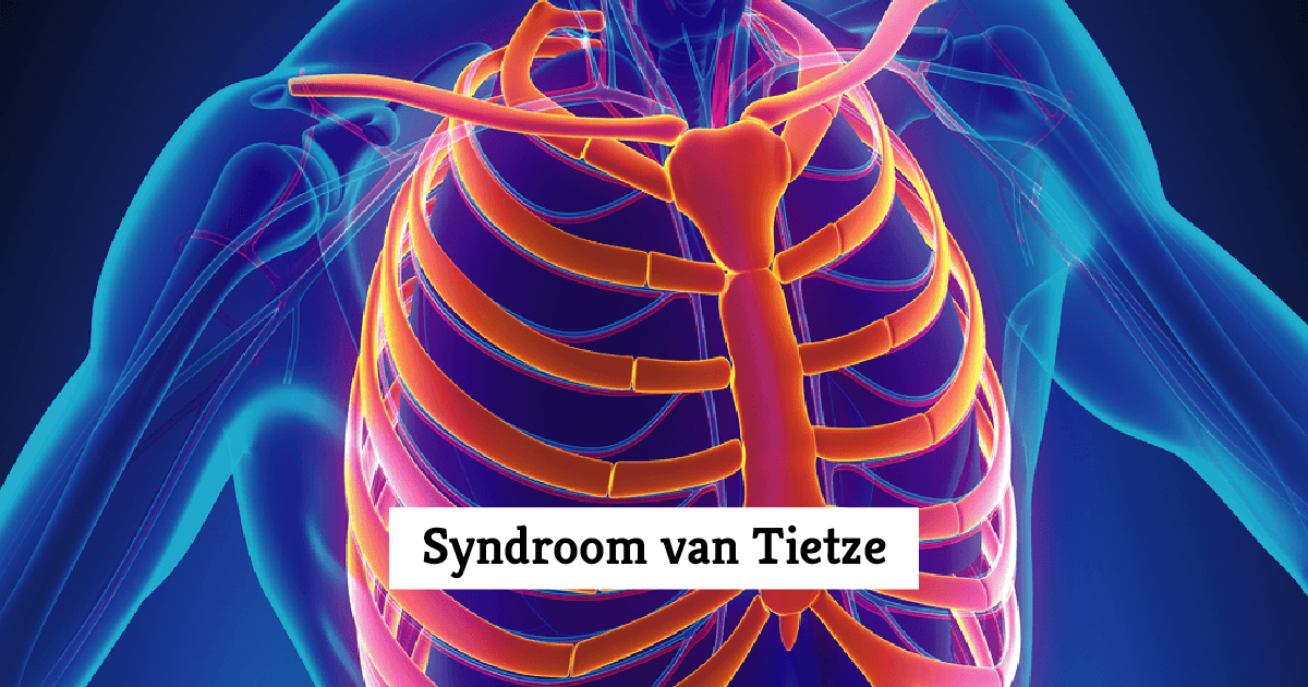 Syndroom Van Tietze Symptomen Oorzaak En Behandeling Mens En My Xxx My XXX Hot Girl Syndroom Van Tietze Symptomen Oorzaak En Behandeling Mens En My Xxx My XXX Hot Girl