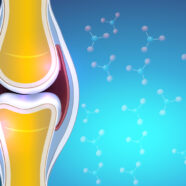 Gewrichtssmeervloeistof speelt sleutelrol bij artrosepijn