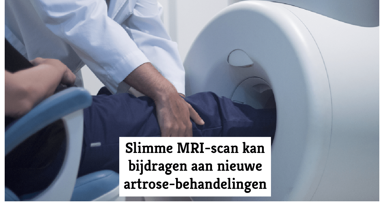 Slimme MRIscan kan bijdragen aan nieuwe artrosebehandelingen Slimme MRIscan kan bijdragen aan nieuwe artrosebehandelingen