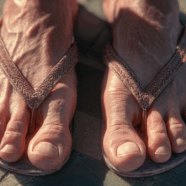 Zomerschoenen vaak boosdoener bij voetpijn