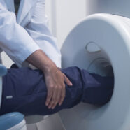 Slimme MRI-scan kan bijdragen aan nieuwe artrose-behandelingen